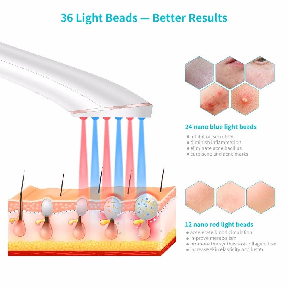 Wireless Rechargeable Acne Light Therapy Device - Get To Find It, LLC
