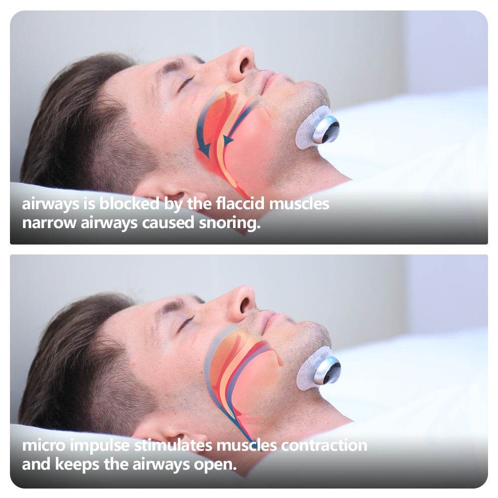 Smart Anti Snoring Device Electronic Muscle Stimulator Plus - Get To Find It, LLC