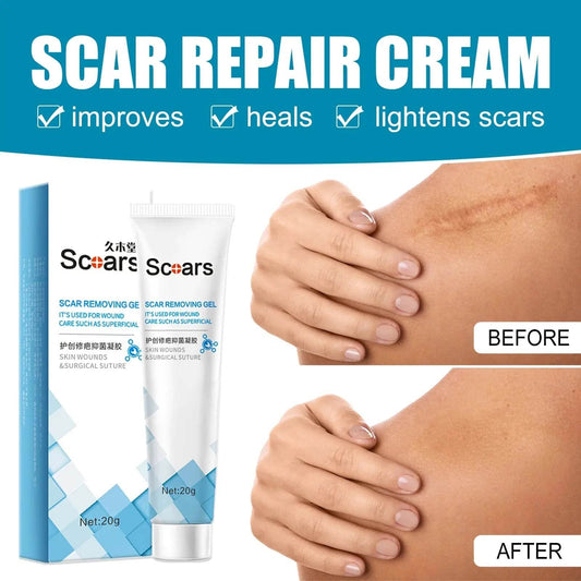 New Herbal Scar Repair Cream - Get To Find It, LLC