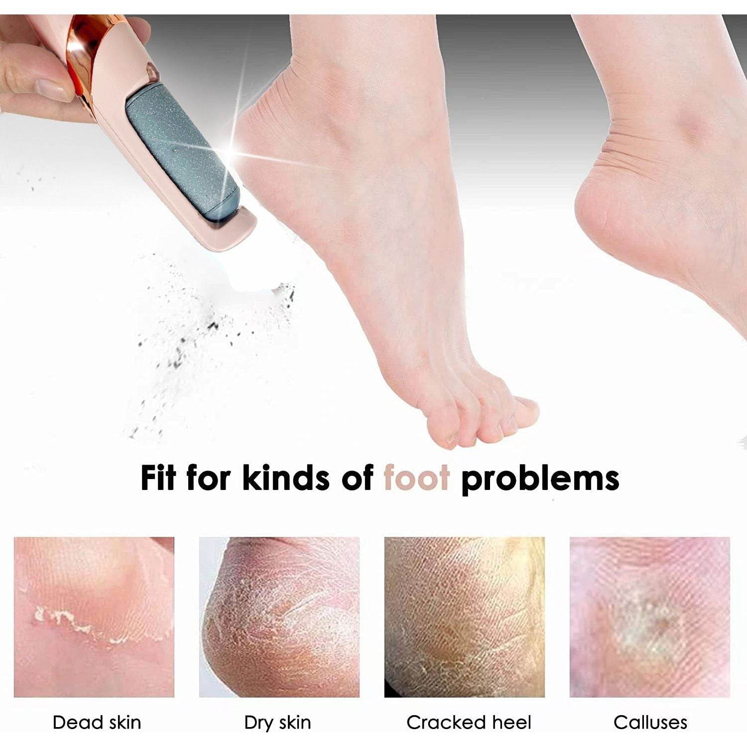 Electric Foot File Callus Remover - Get To Find It, LLC