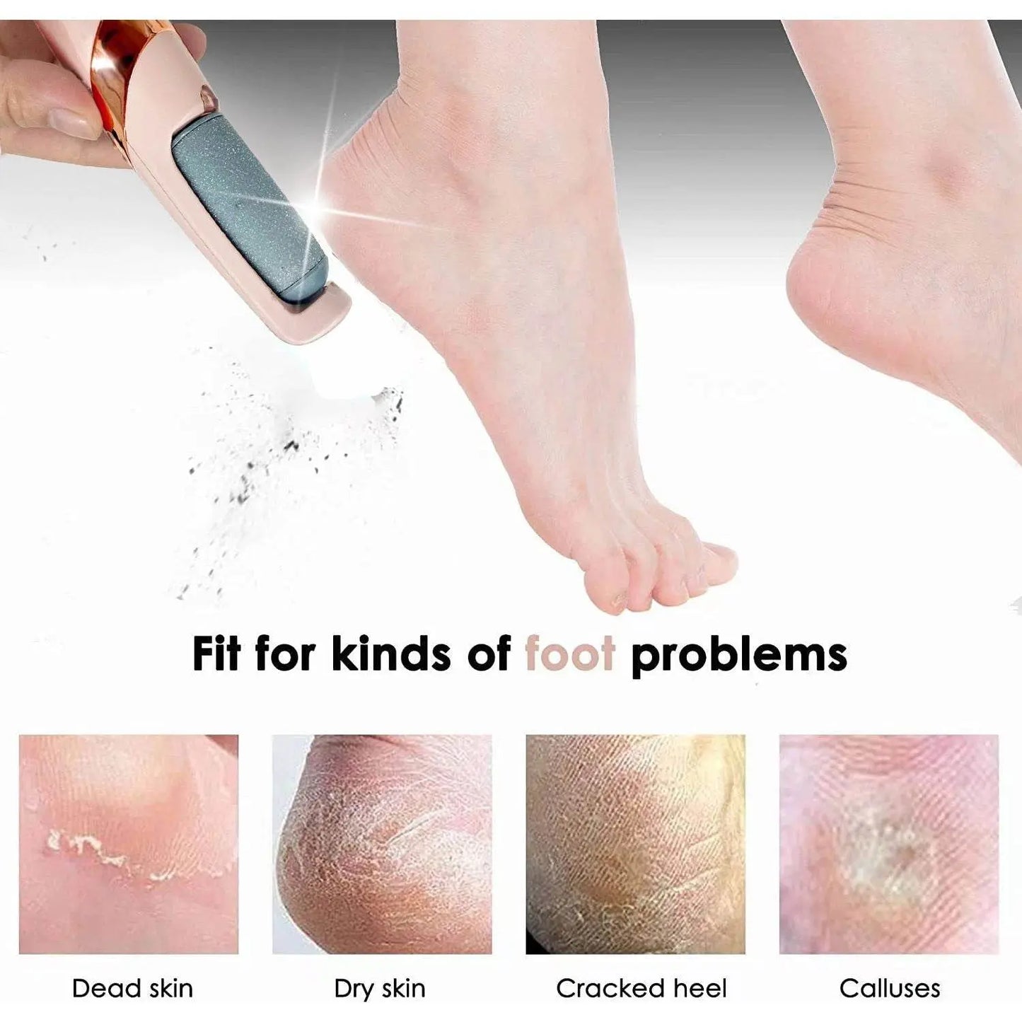 Electric Foot File Callus Remover - Get To Find It, LLC