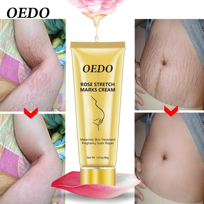 Stretch Mark Cream - Get To Find It, LLC