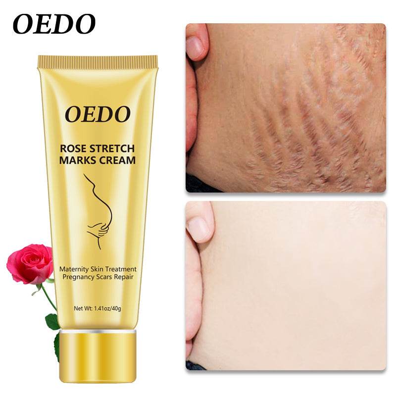 Stretch Mark Cream - Get To Find It, LLC