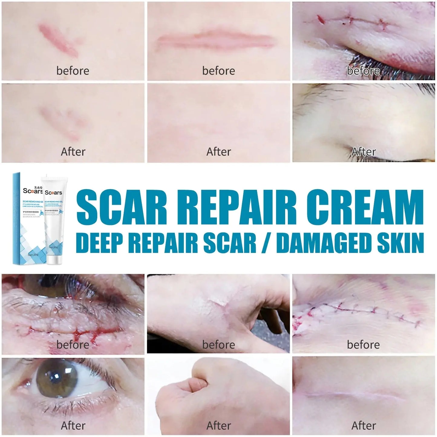 New Herbal Scar Repair Cream