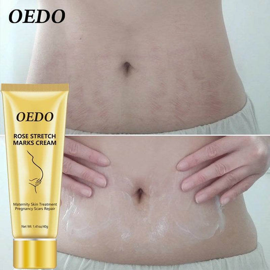 Stretch Mark Cream - Get To Find It, LLC